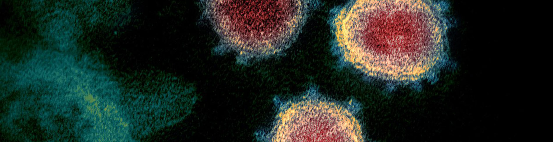 Representation of a microscopic view of the Coronavirus